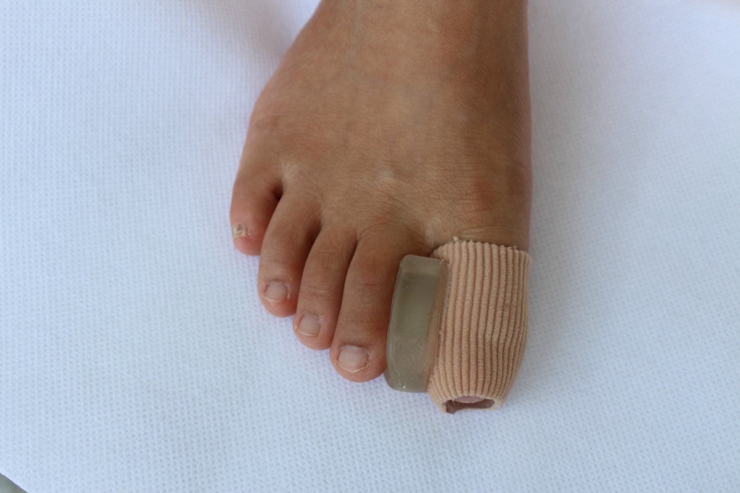 Hallux valgus orthosis